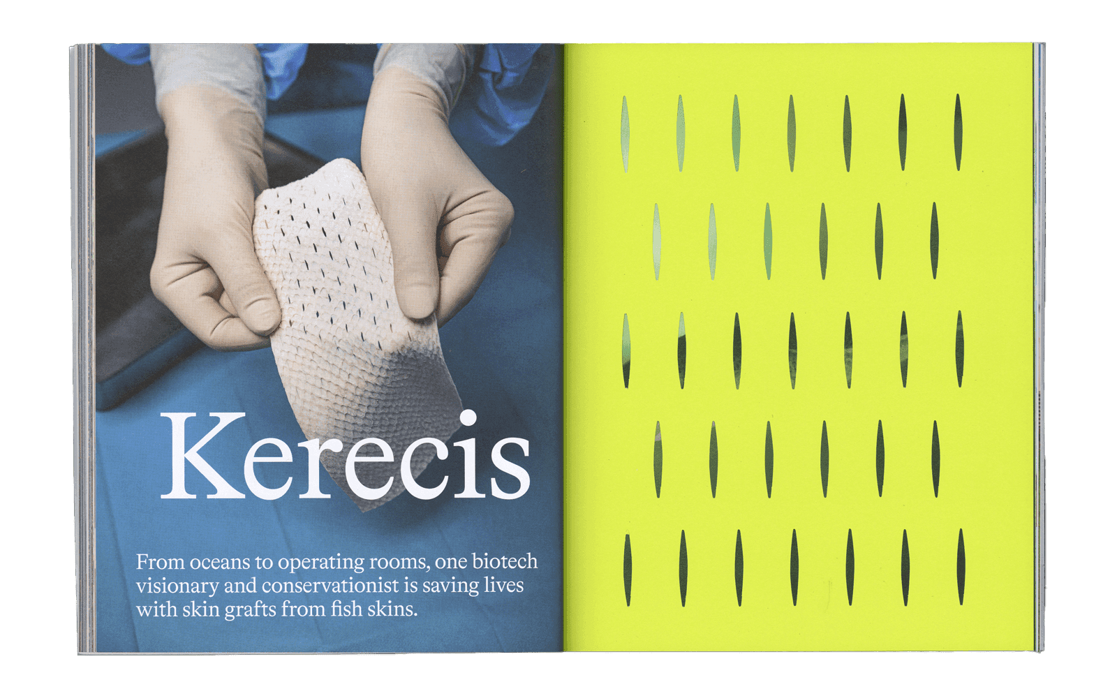 Magazine spread showing two hands stretching some fabric with the text Kerecis below it. On the right page is a yellow fabric texture with slits across and down it